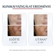 Kép 2/5 - EUCERIN ANTI PIGMENT KORREKTOR STIFT 5ML