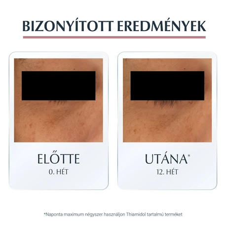 EUCERIN ANTI PIGMENT SZEMRANCKREM 15ML