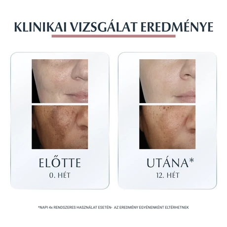 EUCERIN ANTI PIGMENT NAPPALI ARCKRÉM FF30 50ML