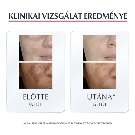 EUCERIN ANTI PIGMENT ARCKRÉM ÉJSZAKAI 50ML