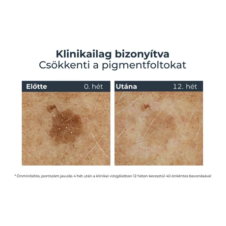 EUCERIN HYALURON-FILLER+ELASTICITY 3D SZÉRUM 30ML